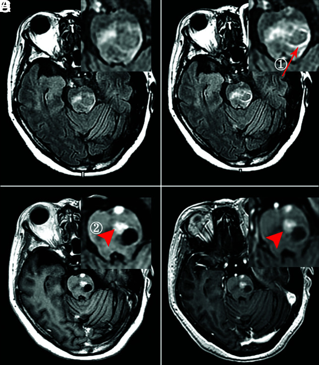 FIG 5.