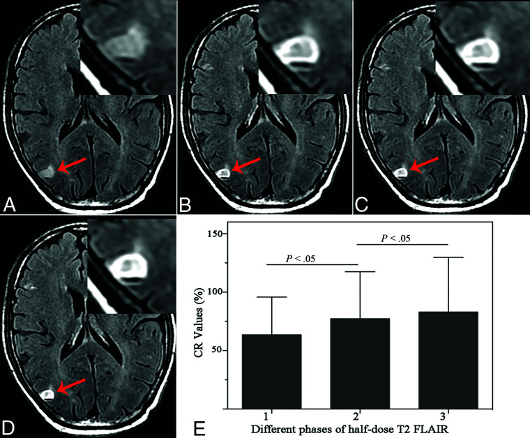 FIG 3.