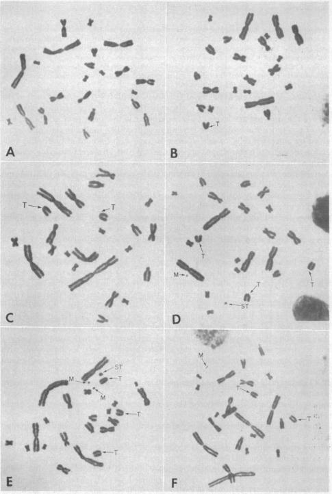 graphic file with name pnas00147-0371-a.jpg