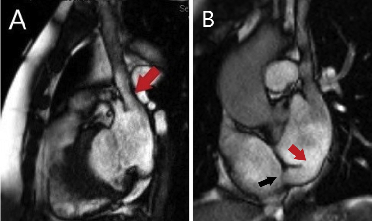 Figure 3