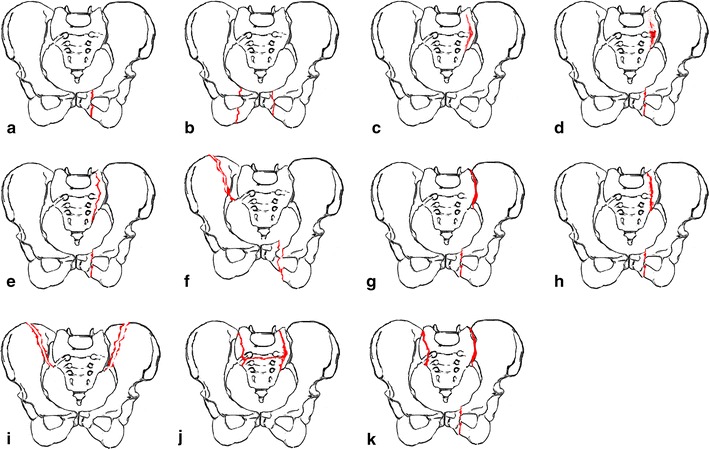 Fig. 2