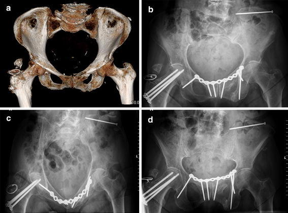 Fig. 7