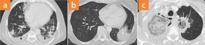 graphic file with name 15033_2021_2754_Fig7_HTML.jpg