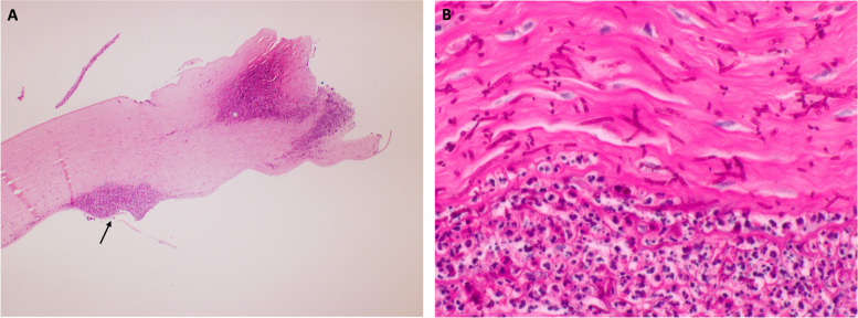 Fig. 5