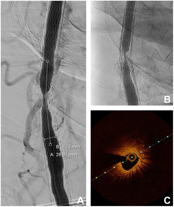 Figure 3.