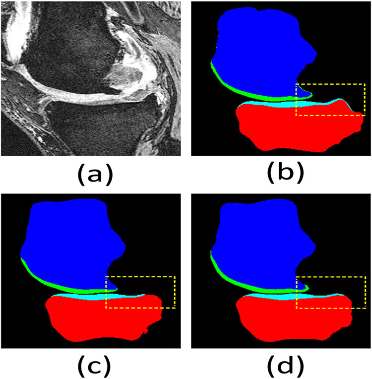 Fig. 12.