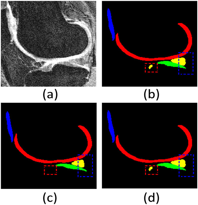 Fig. 13.