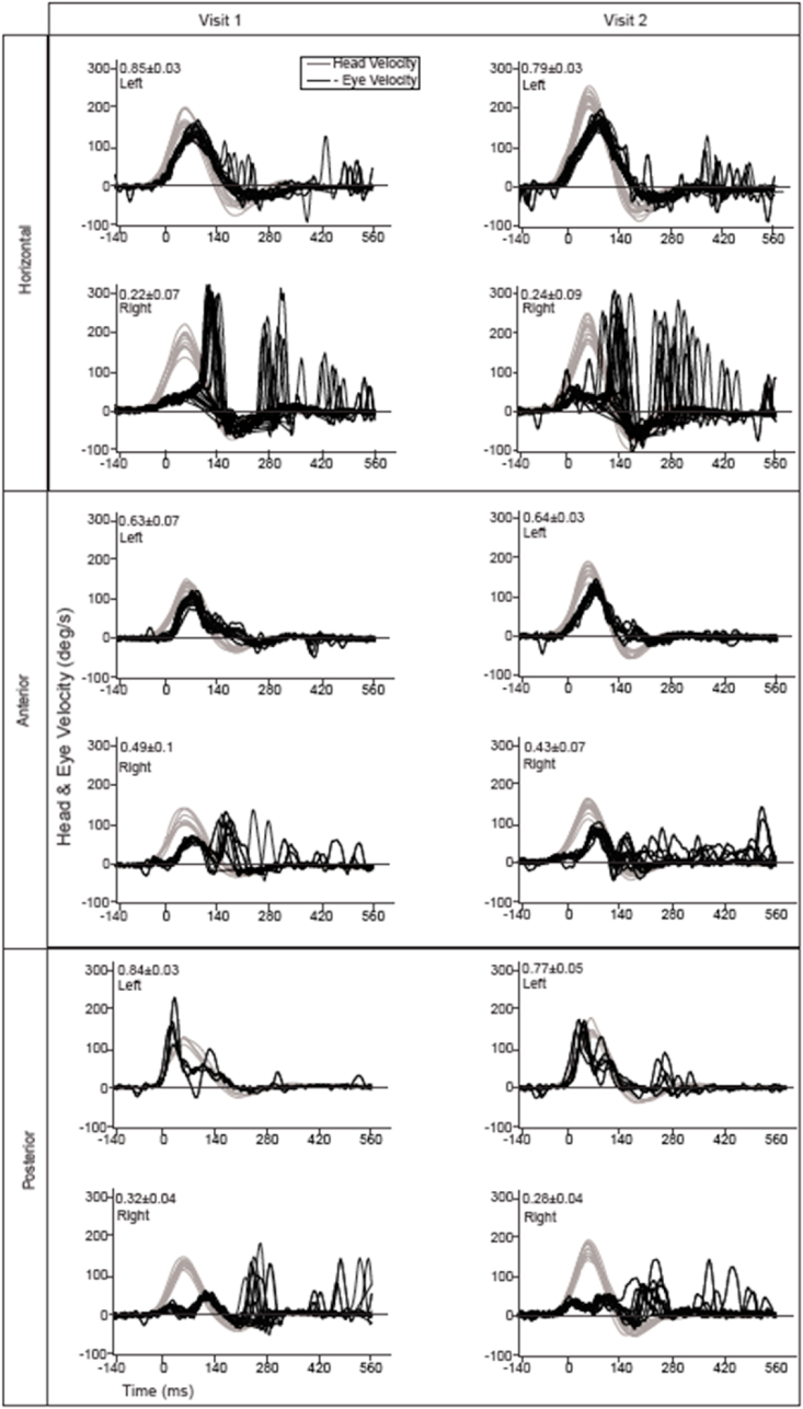 Fig. 3