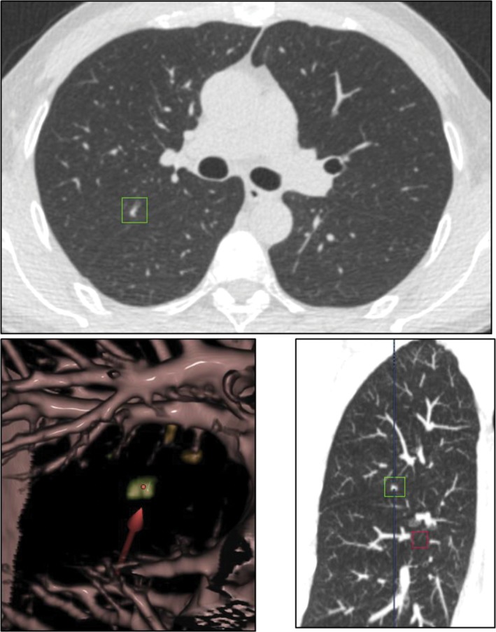 Figure 6