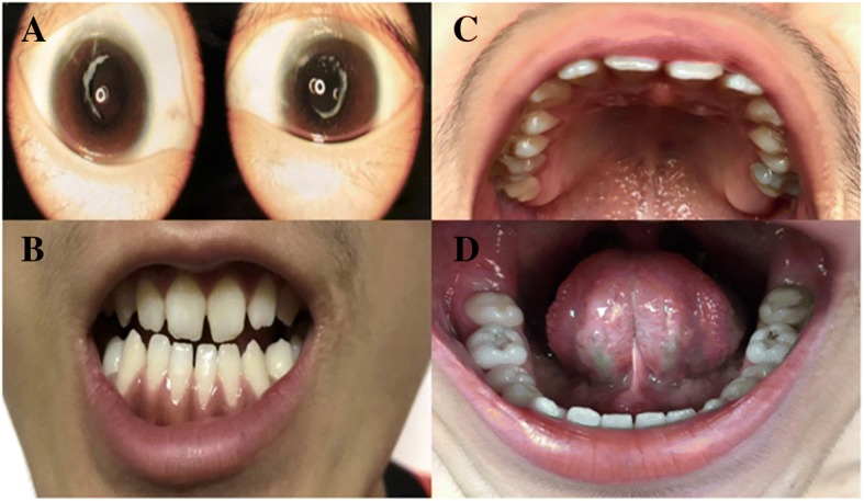 Fig. 1