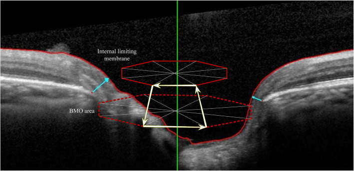 Fig. 1