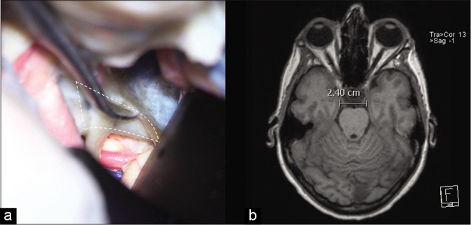 Figure 2: