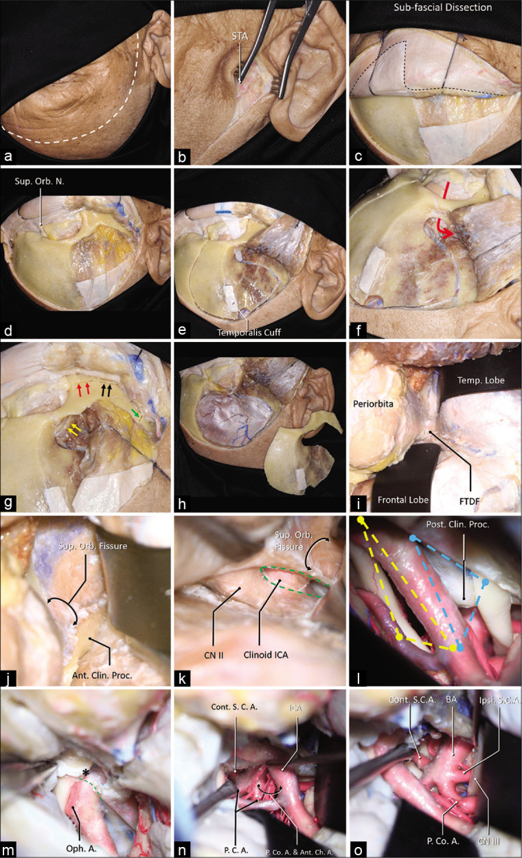 Figure 1: