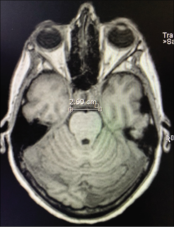 Figure 4: