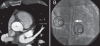 Figure 1)