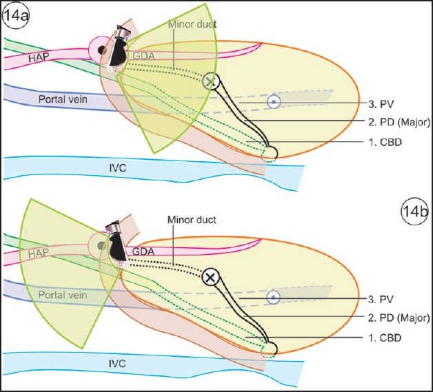 Figure 14