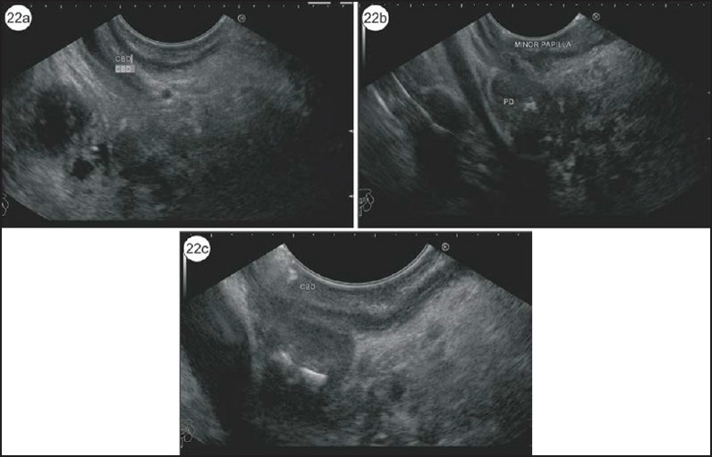 Figure 22