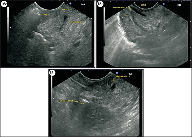 Figure 15