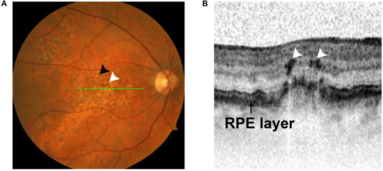 FIGURE 4