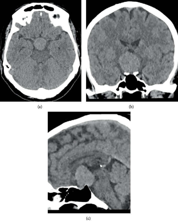 Figure 1