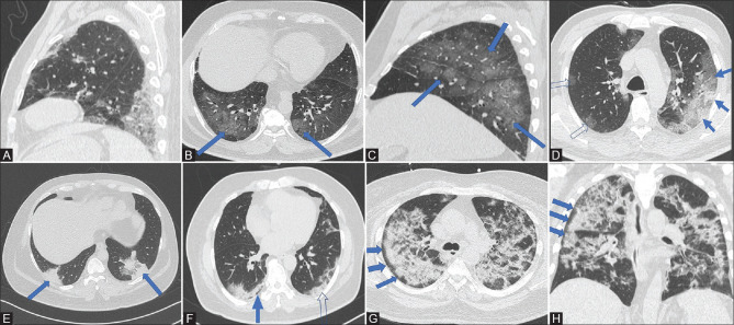 Figure 1 (A-H)