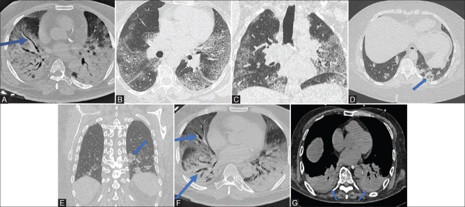 Figure 3 (A-G)