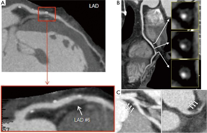 Figure 11