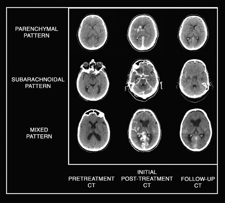 Fig 1.