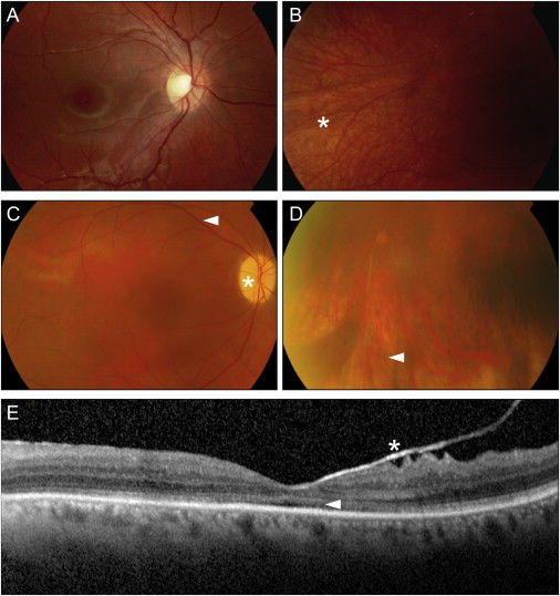 Figure 2