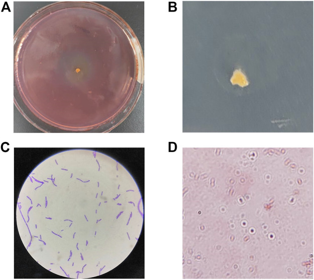 FIGURE 1