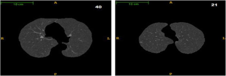 Fig. 7