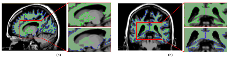 Figure 9