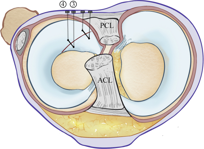 Fig 5