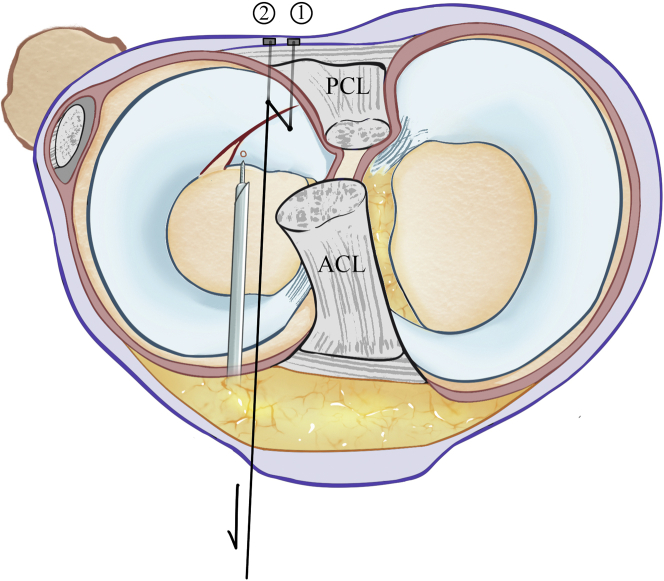 Fig 3