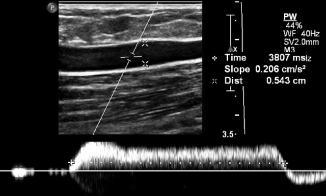 Figure 6