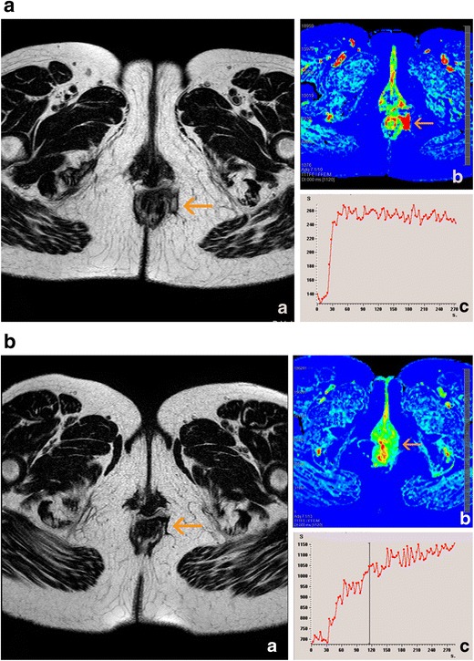 Fig. 11