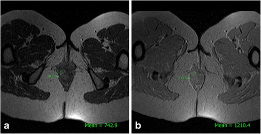 Fig. 12