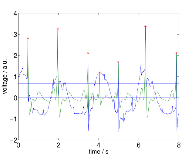 Figure 11