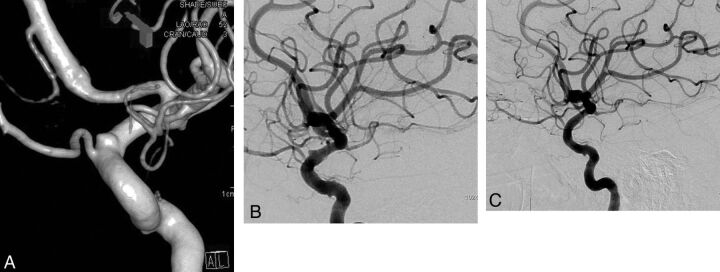 Fig 4.