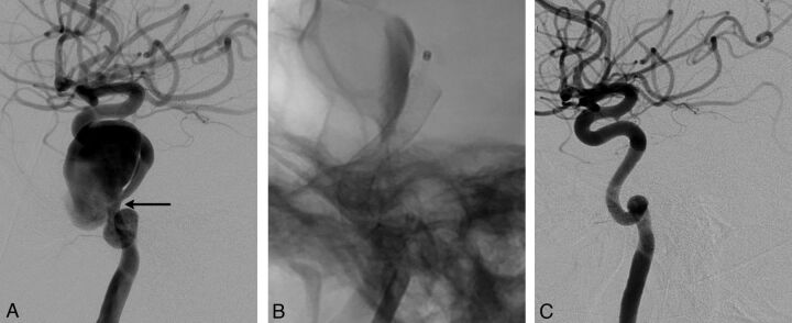 Fig 2.