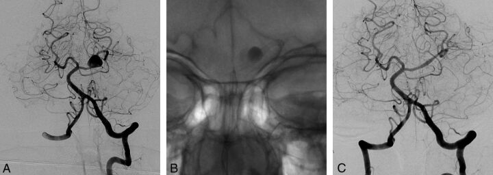 Fig 3.