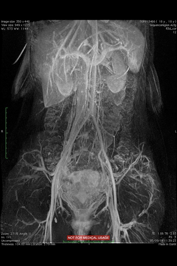 Fig. 4b: