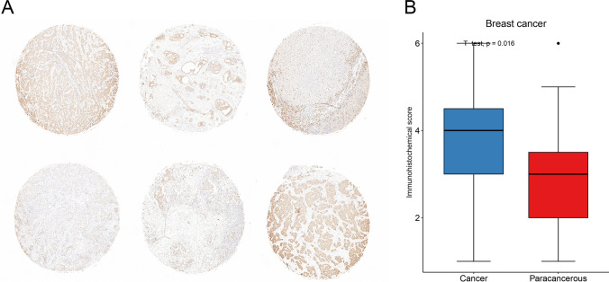 Fig. 14