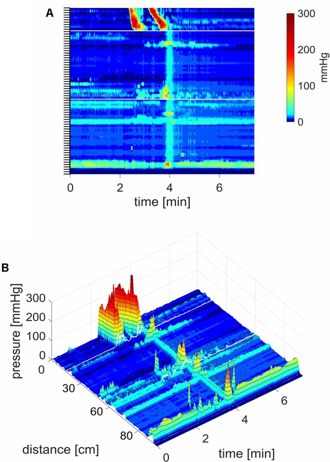 FIGURE 4