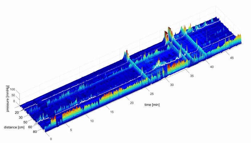 FIGURE 12