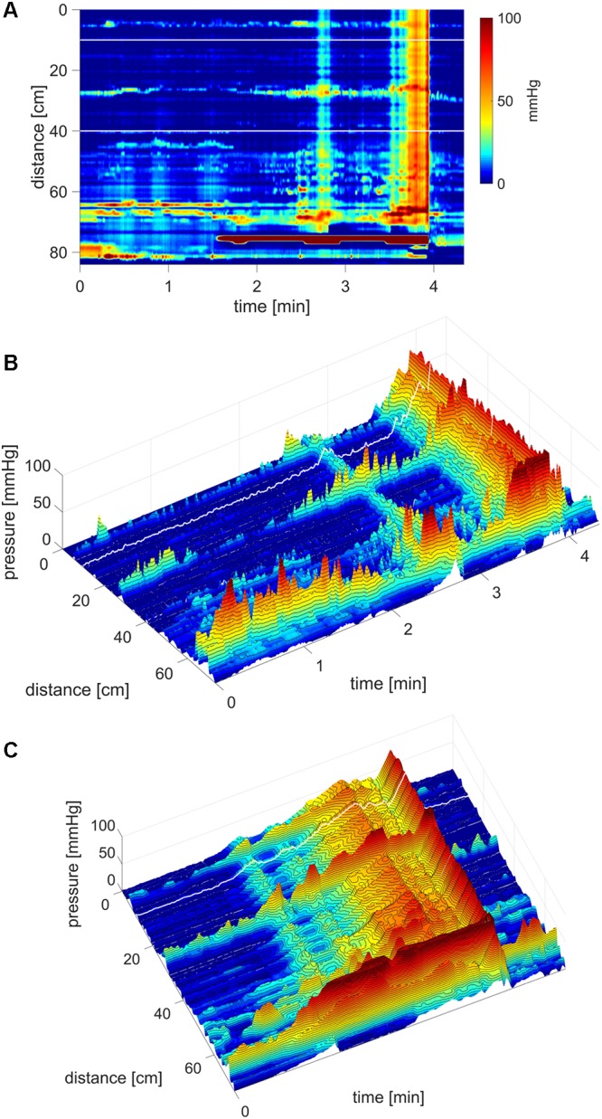 FIGURE 11