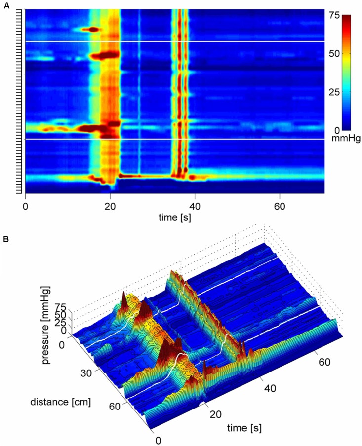 FIGURE 10