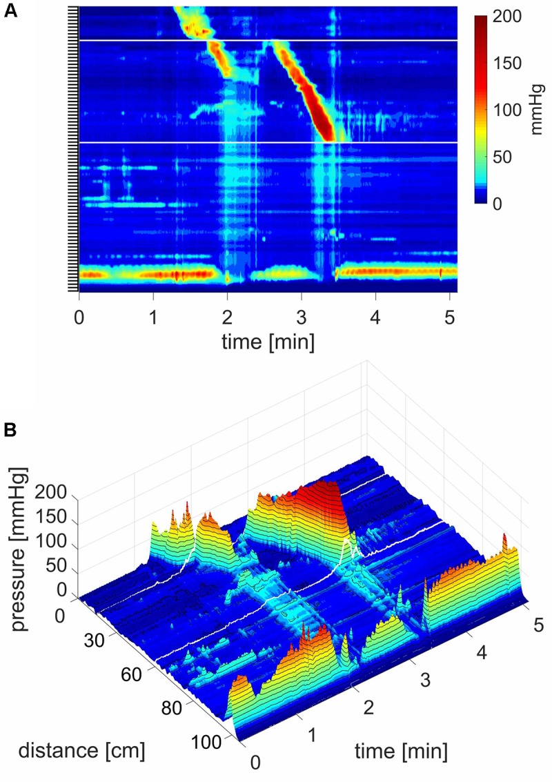 FIGURE 2