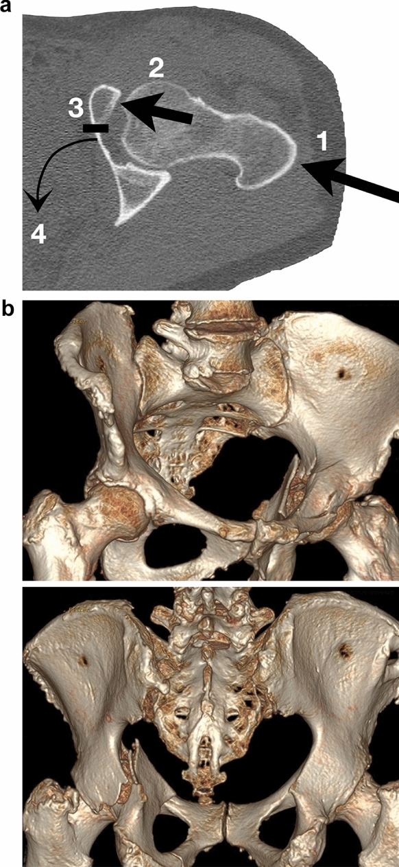 Fig. 1