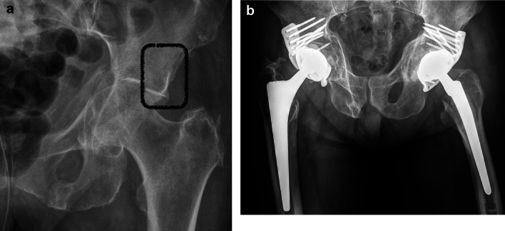 Fig. 6